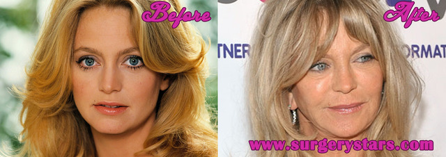goldie porn pictures after before hosted goldie hawn estergoldberg