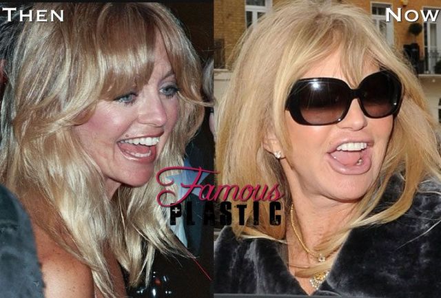 goldie porn that goldie plastic surgery hawn successfully