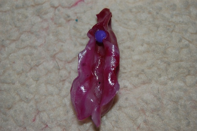 mature vulva pictures pin bdadcc