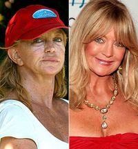 goldie porn goldie hawn plastic surgery results